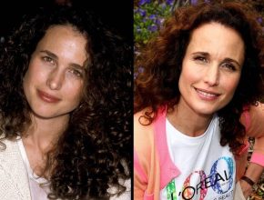 Andie Macdowell before and after plastic surgery