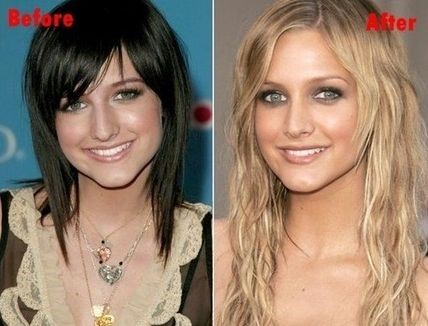 Ashlee Simpson before and after plastic surgery