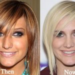 Ashlee Simpson before and after plastic surgery 24