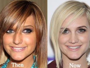 Ashlee Simpson before and after plastic surgery 24