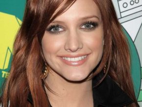 Ashlee Simpson plastic surgery 26