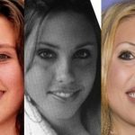 Chloe Lattanzi before and after plastic surgery 40