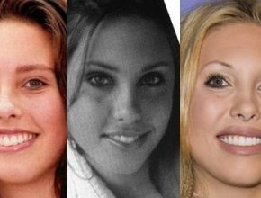 Chloe Lattanzi before and after plastic surgery 40