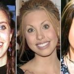 Chloe Lattanzi before and after plastic surgery 41