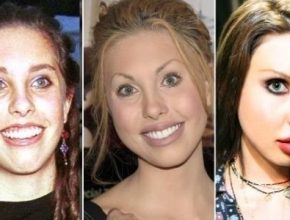 Chloe Lattanzi before and after plastic surgery 41