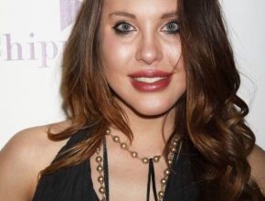 Chloe Lattanzi plastic surgery 32