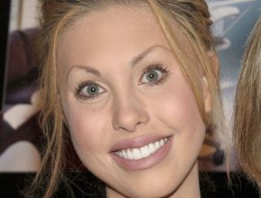 Chloe Lattanzi plastic surgery