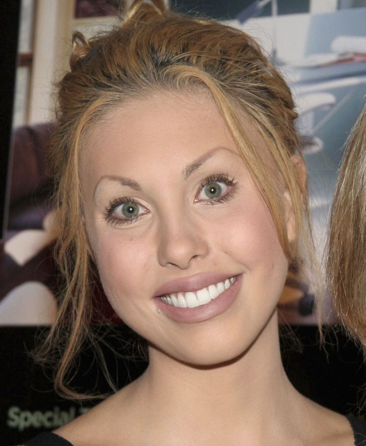 Chloe Lattanzi plastic surgery 