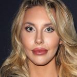 Chloe Lattanzi plastic surgery 46