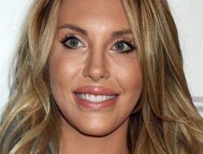 Chloe Lattanzi plastic surgery 65