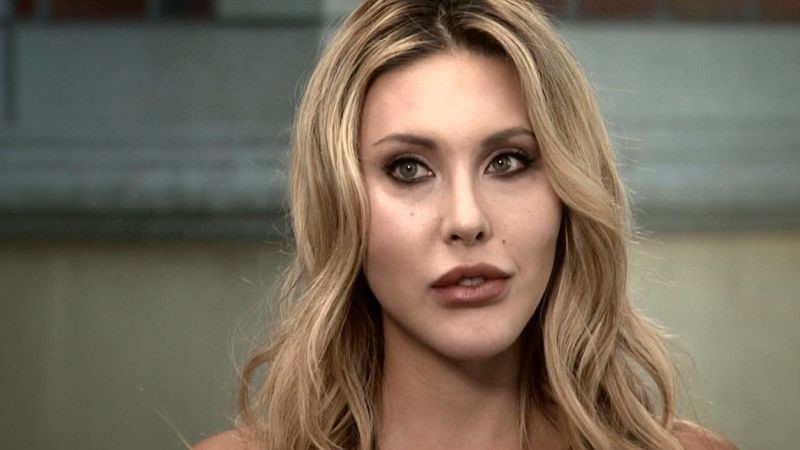 Chloe Lattanzi plastic surgery