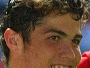 Cristiano Ronaldo before and after plastic surgery 7