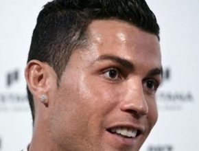 Cristiano Ronaldo plastic surgery 16