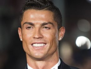 Cristiano Ronaldo plastic surgery 20