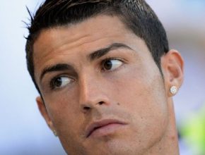 Cristiano Ronaldo plastic surgery 24