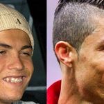 Cristiano Ronaldo plastic surgery 27