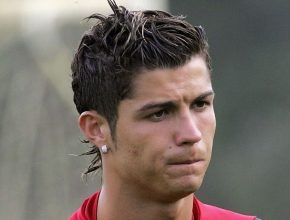 Cristiano Ronaldo plastic surgery 35