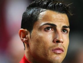 Cristiano Ronaldo plastic surgery 36