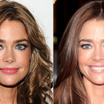 Denise Richards before and after plastic surgery 1