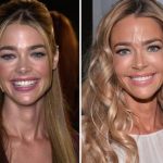 Denise Richards before and after plastic surgery 40