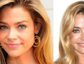 Denise Richards before and after plastic surgery 41