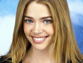 Denise Richards plastic surgery 17