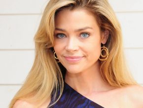 Denise Richards plastic surgery 8