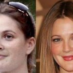 Drew Barrymore before an after plastic surgery 10
