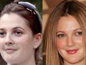 Drew Barrymore before an after plastic surgery 10