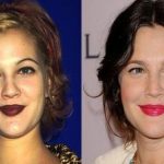Drew Barrymore before an after plastic surgery 26