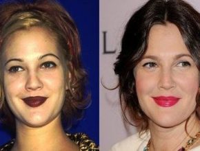 Drew Barrymore before an after plastic surgery 26