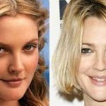 Drew Barrymore before an after plastic surgery 4