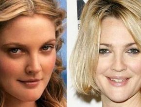 Drew Barrymore before an after plastic surgery 4