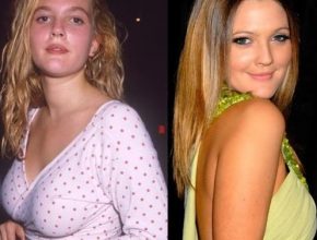 Drew Barrymore before an after plastic surgery