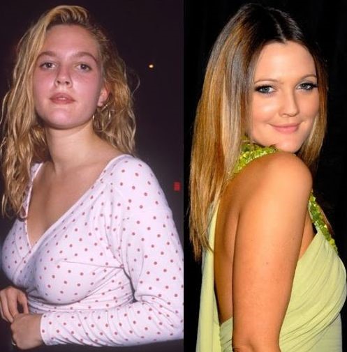 Drew Barrymore before and after plastic surgery