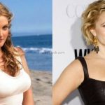 Drew Barrymore before an after plastic surgery 43