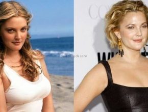 Drew Barrymore before an after plastic surgery 43