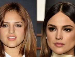 Eiza Gonzalez before and after plastic surgery