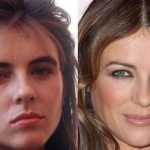 Elizabeth Hurley before and after plastic surgery 15