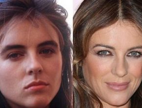 Elizabeth Hurley before and after plastic surgery 15