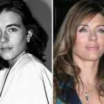 Elizabeth Hurley before and after plastic surgery 14