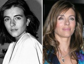 Elizabeth Hurley before and after plastic surgery 14
