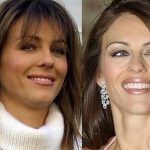 Elizabeth Hurley before and after plastic surgery 16