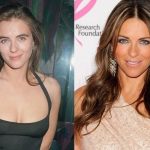 Elizabeth Hurley before and after plastic surgery 27