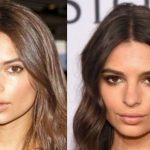 Emily Ratajkowski before and after plastic surgery 12