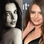 Emily Ratajkowski before and after plastic surgery 01