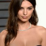 Emily Ratajkowski plastic surgery 26