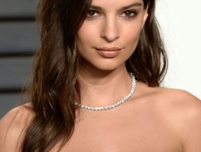 Emily Ratajkowski plastic surgery 26