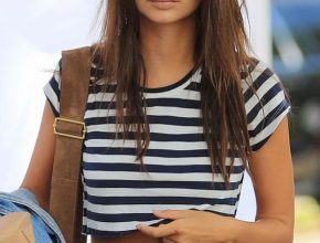 Emily Ratajkowski plastic surgery 4