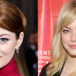 Emma Stone before and after plastic surgery 35